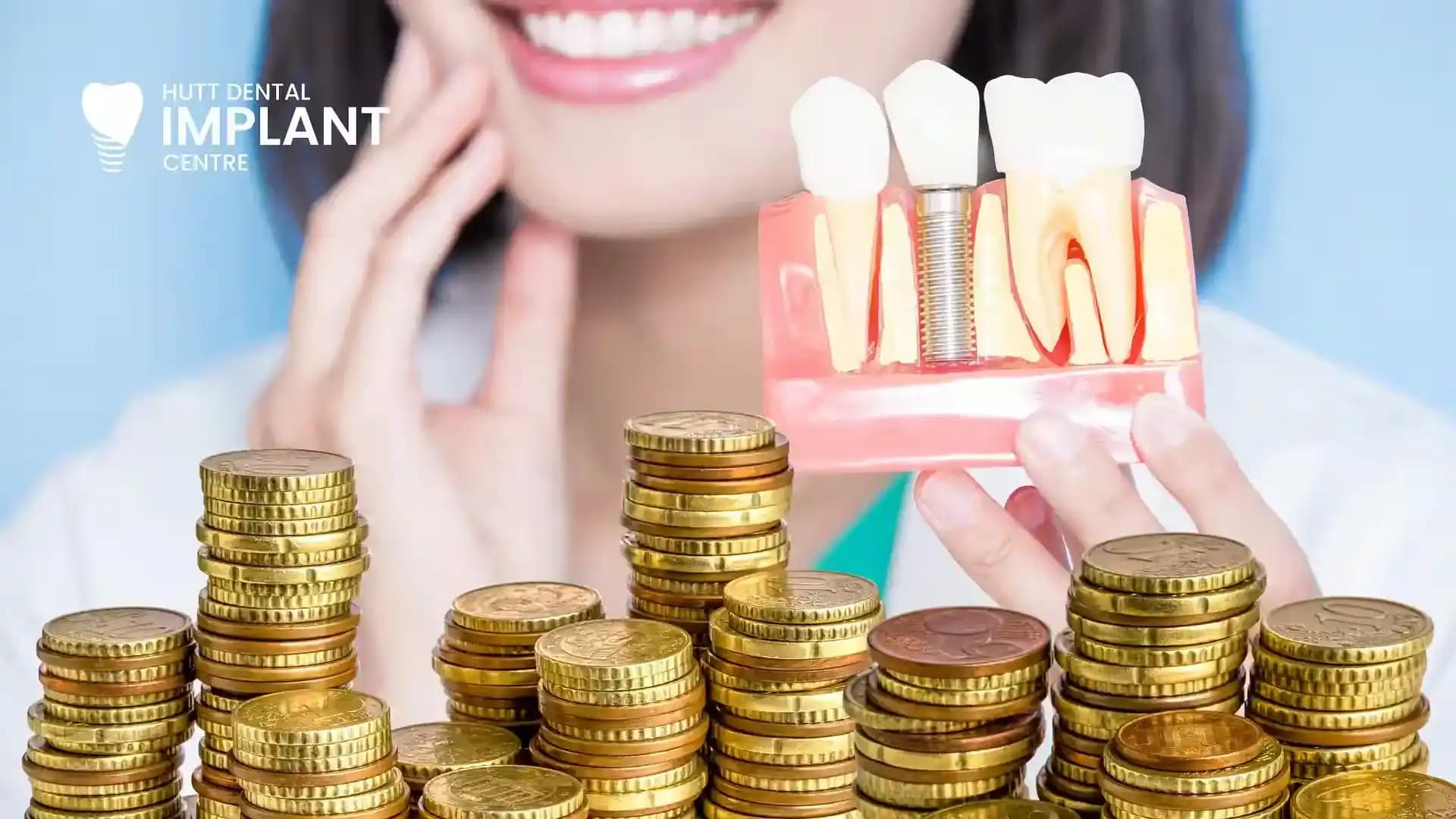 HDIC - What’s the Cost of Full-Arch