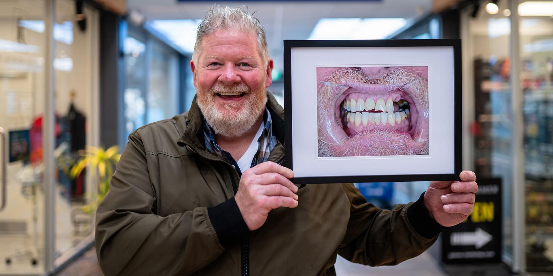 patient showing a before photo of his teeth before his dental implant procedure